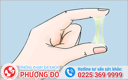 Dịch Vàng Vùng Kín Ở Nữ