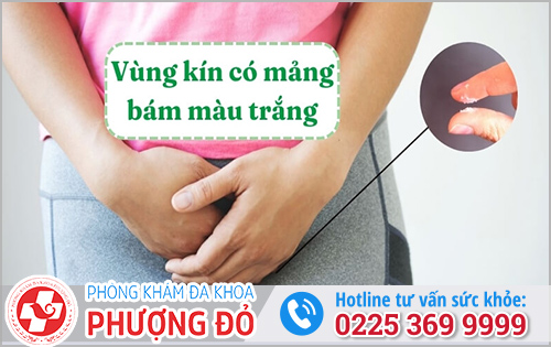 Mảng Bám Trắng Ở Vùng Kín