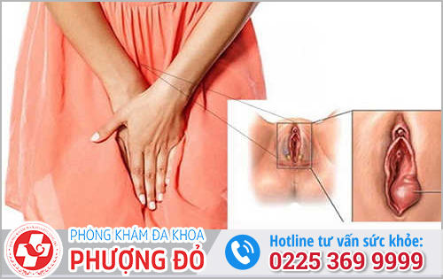 Nổi Hạch Âm Đạo Ở Nữ: Khi Nào Cần Đi Khám Ngay?