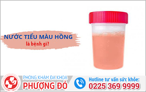 Nước Tiểu Màu Hồng Là Bệnh Gì?