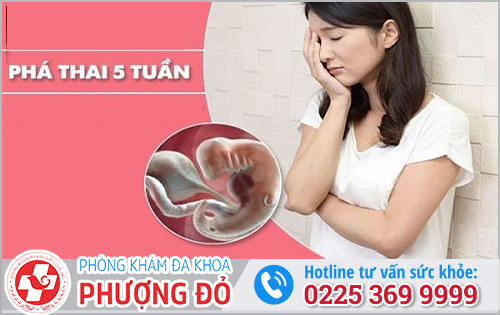 Phá Thai 5 Tuần Tuổi: Những Điều Cần Biết Trước Khi Quyết Định