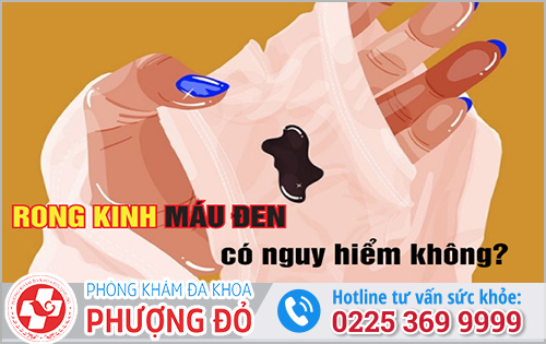 Rong Kinh Máu Đen Ở Nữ