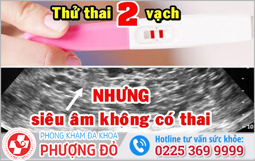 Thử Que 2 Vạch Nhưng Siêu Âm Không Có Thai?