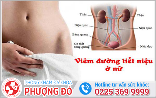 Viêm đường tiết niệu ở nữ không nên xem nhẹ