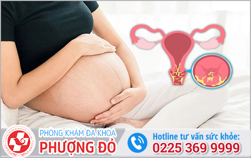 Viêm lộ tuyến cổ tử cung khi mang thai có nguy hiểm không?