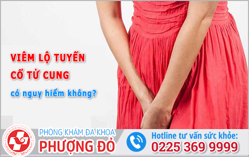 Viêm lộ tuyến cổ tử cung có nguy hiểm không?