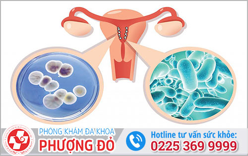 Các Bệnh Vùng Kín Nữ Thường Gặp: Dấu hiệu Nhận Biết Và Cách Điều Trị