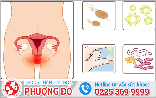 Bệnh vùng kín ở nữ là gì?