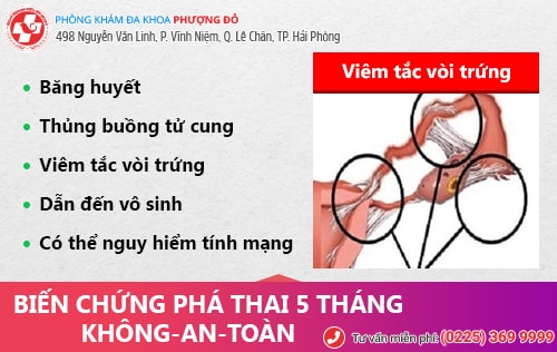 phá thai 5 tháng