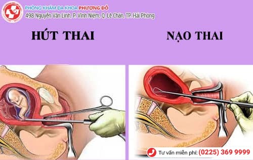 các cách phá thai, cách phá thai theo tuần, tháng