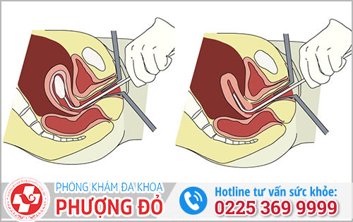 Các Phương Pháp Bỏ Thai An Toàn Theo Tuần Chị Em Cần Biết