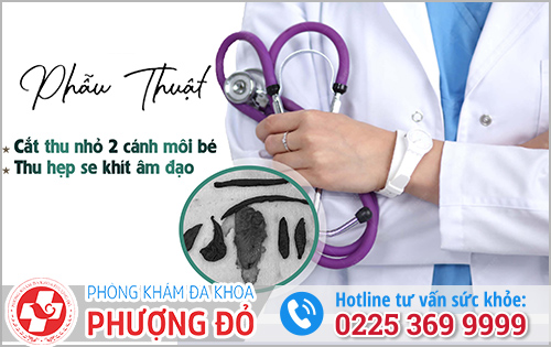 Phượng Đỏ – Địa Chỉ Cắt Môi Bé Đẹp, An Toàn Ở Hải Phòng