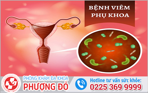 Dấu hiệu viêm nhiễm phụ khoa