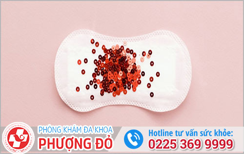 Dấu Hiệu Kinh Nguyệt Bất Thường Và Địa Chỉ Khám Phụ Khoa Uy Tín