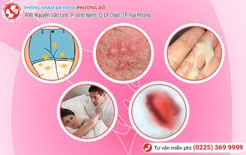 Điểm danh những bệnh phụ nữ phổ biến ở chị em