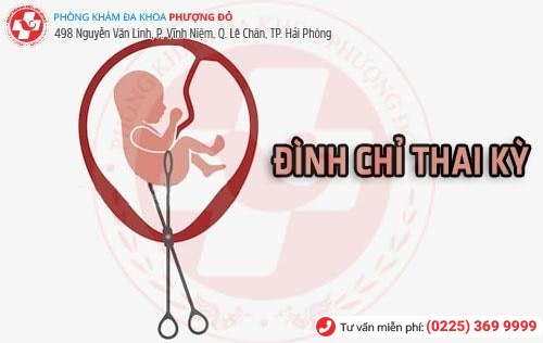 Các phương pháp đình chỉ thai kỳ