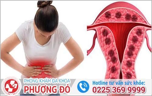 Hiện tượng kinh nguyệt ra nhiều do bệnh lý