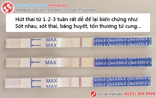 Hút thai 1 tuần, hút thai 2 tuần, hút thai 3 tuần