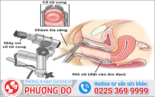 Khám cổ tử cung nhanh hiệu quả