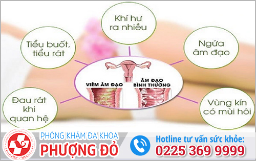 Khám Sản Phụ Khoa Khám Bệnh Nữ Giới