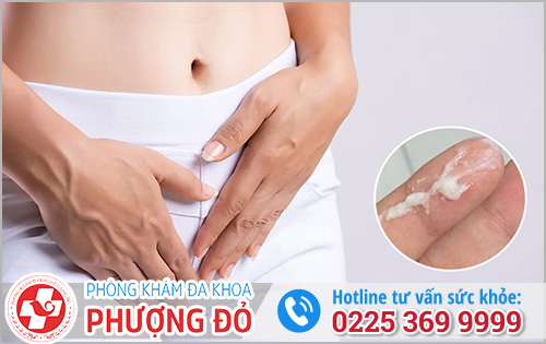 Nguyên nhân ra dịch khí hư như bã đậu