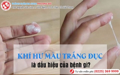 Khí hư màu trắng đục mùi hôi tanh là bị bệnh gì?