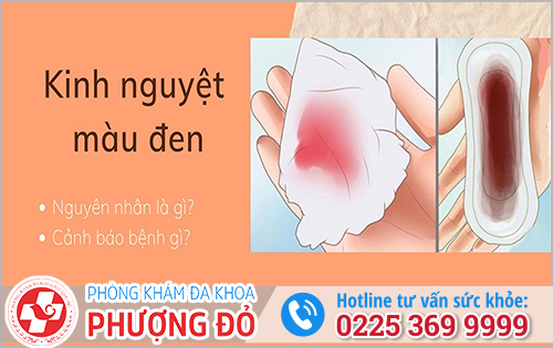 Kinh Nguyệt Màu Đen Dấu Hiệu Bệnh Phụ Khoa Nào?