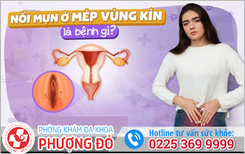 Mép vùng kín xuất hiện mụn là bệnh gì?