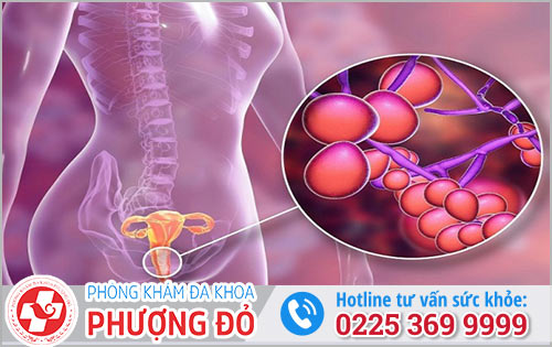 Nấm vùng kín ở nữ có sao không?