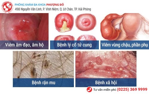 Tại sao vùng kín có mùi?