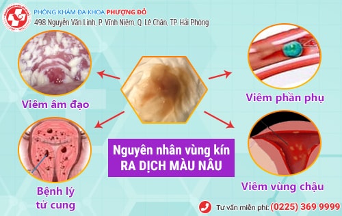 Nguyên nhân khiến vùng kín ra dịch nâu