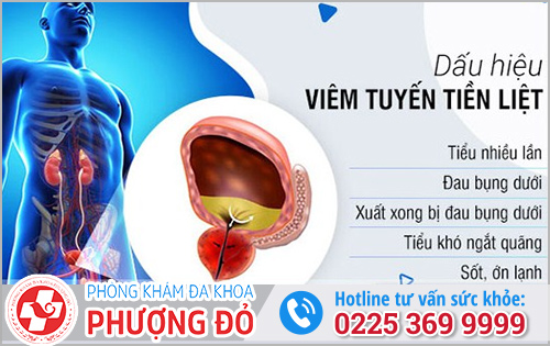 Nhận Biết Viêm Tuyết Tiền Luyệt Ở Nữ