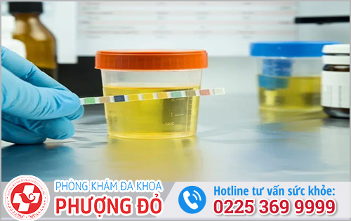 Địa Chỉ Hỗ Trợ Thăm Khám Nước Tiểu Có Màu Lạ Ở Nữ