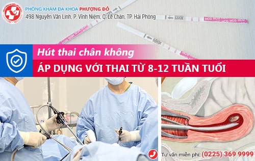 Cách phá thai 11 tuần, phá thai 12 tuần không đau, về ngay trong ngày