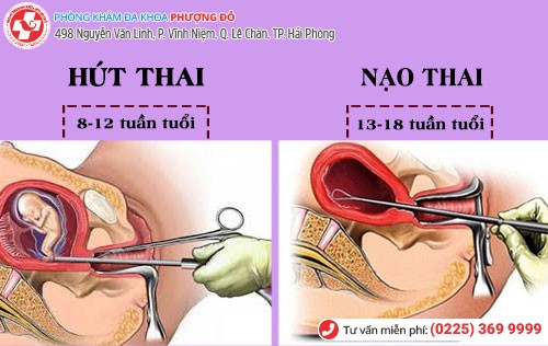 phá thai 3 tháng