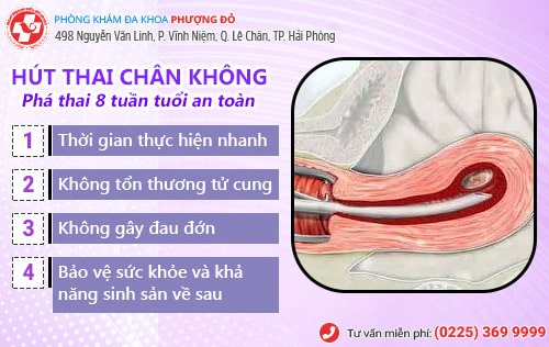 Phương pháp hút thai 8 tuần an toàn tại Đa Khoa Phượng Đỏ