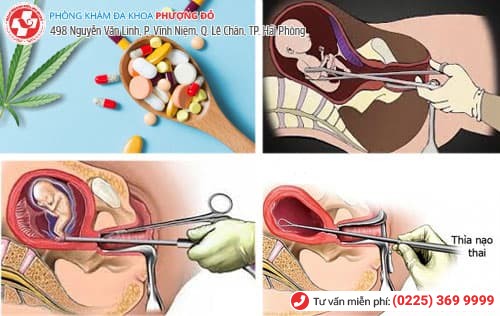 Phá thai nhanh phải đi đôi với chất lượng