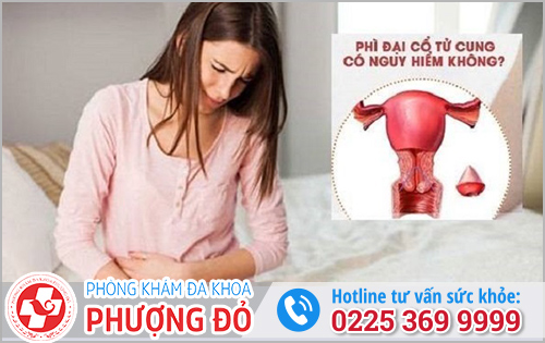 Phì Đại Cổ Tử Cung Như Thế Nào?