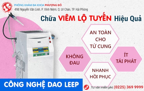 Những thông tin về phương pháp đốt viêm lộ tuyến