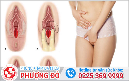 Quan Hệ Bị Rách Cửa Mình Có Sao Không?