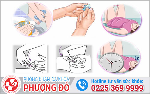 Thuốc đặt âm đạo sử dung như thế nào hiệu quả?