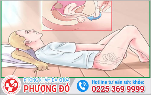 Công Dụng Của Thuốc Đặt Âm Đạo