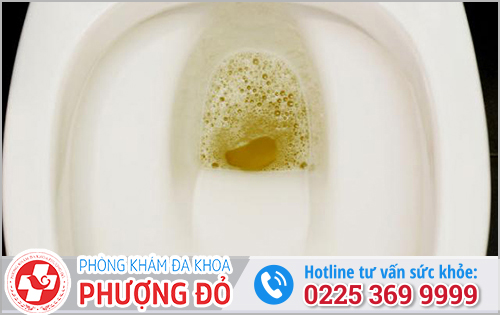 Nước Tiểu Ra Bọt Là Bệnh Gì?