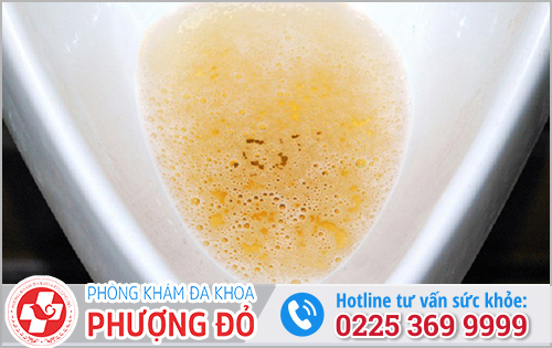 Tiểu có bọt