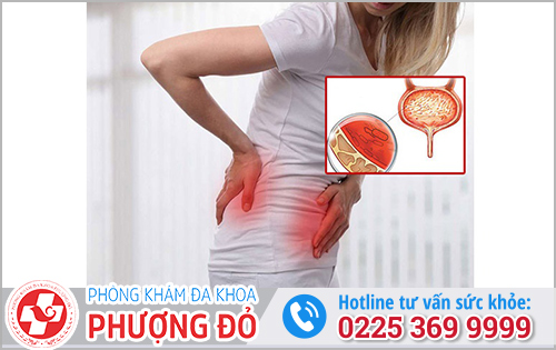 Mối nguy hiểm khi bị viêm bàng quang 