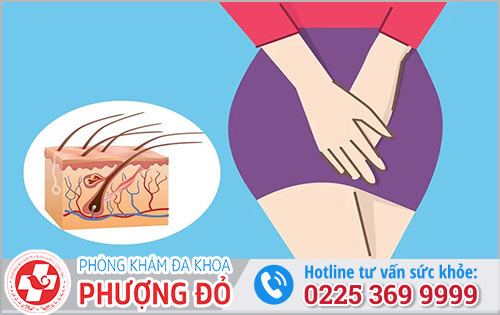 Dấu hiệu và và yếu tố gây viêm nang lông vùng kín ở nữ