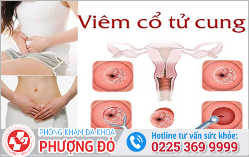 Dấu Hiệu Viêm Tử Cung